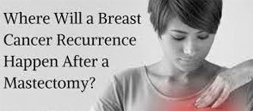 Breast Cancer Recurrence