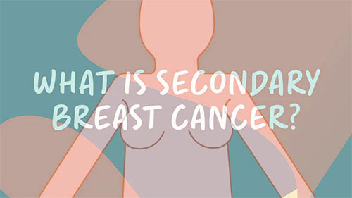 Breast Cancer Recurrence