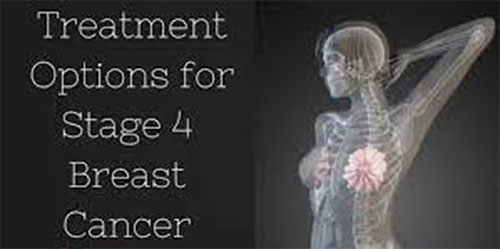 Breast Cancer Recurrence