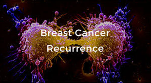 Breast Cancer Recurrence