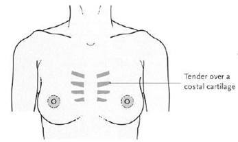 Breast Pain/Mastalgia