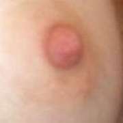 Normal Nipples