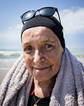 Treatment for Early Breast Cancer