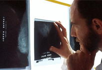 Treatment for Early Breast Cancer