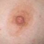 Normal Nipples