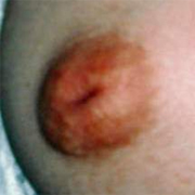 Normal Nipples