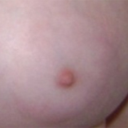 Normal Nipples