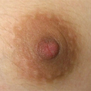 Normal Nipples