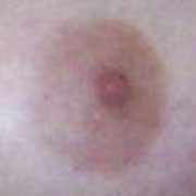 Normal Nipples