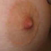 Normal Nipples