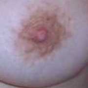 Normal Nipples