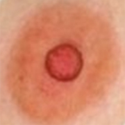 Normal Nipples