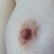 Normal Nipples