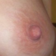 Normal Nipples