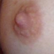 Normal Nipples