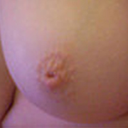 Normal Nipples