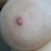 Normal Nipples