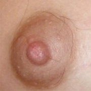 Normal Nipples