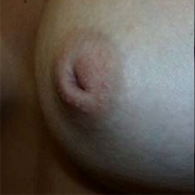 Normal Nipples