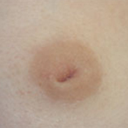 Normal Nipples