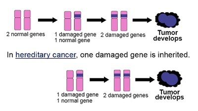 Hereditary Cancer