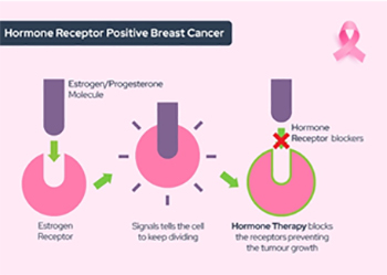 Infiltrating Lobular Carcinoma (ILC)