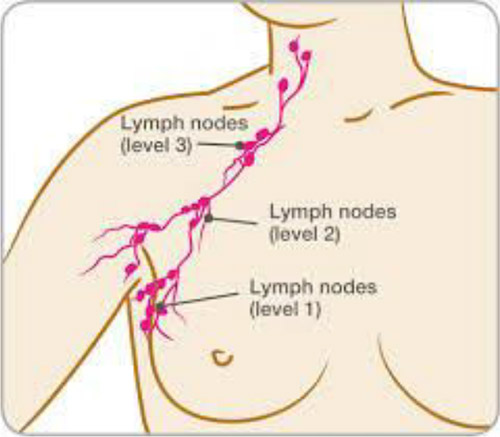 INITIAL TREATMENT DECISIONS