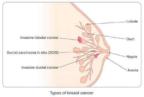 INITIAL TREATMENT DECISIONS