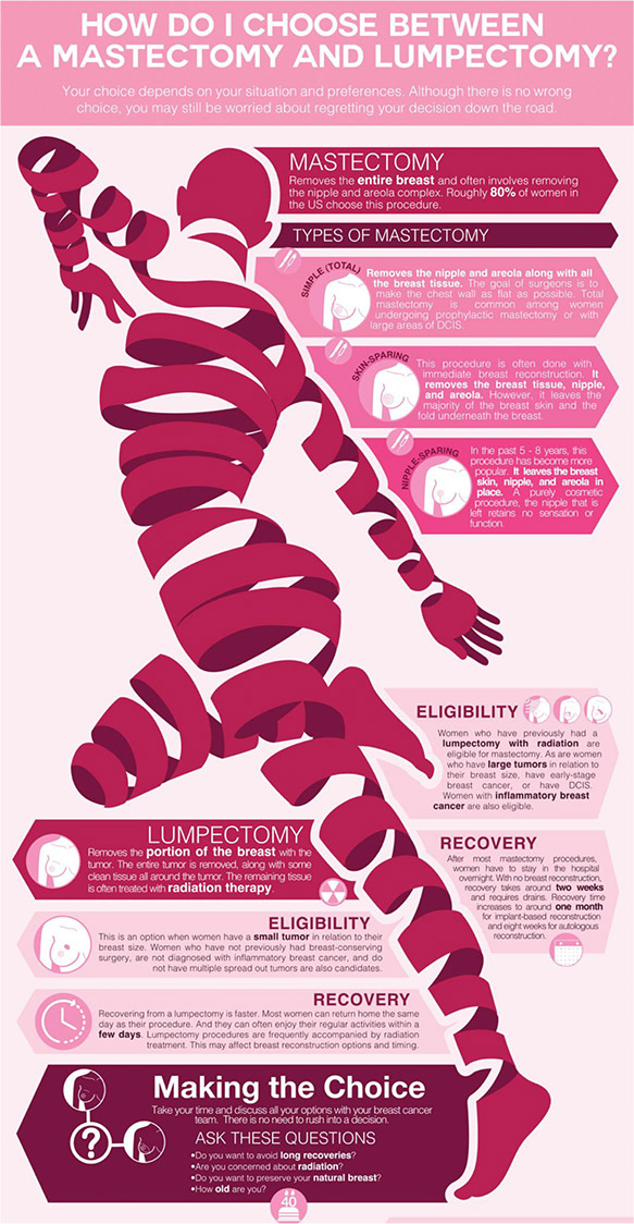  Lumpectomy vs. Mastectomy: How to Choose 