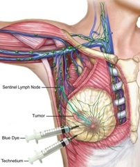 Lymph Glands/Nodes?