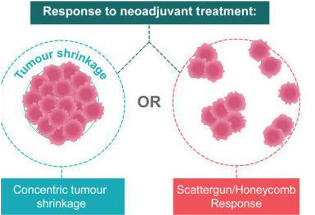 NEOADJUVANT THERAPY OVERVIEW