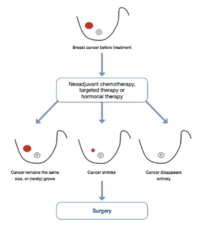 NEOADJUVANT THERAPY PERSONAL APPROACH and PRACTICAL ASPECTS