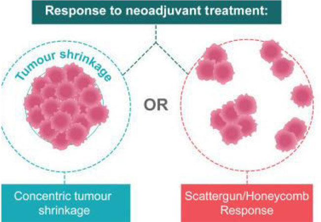 NEOADJUVANT THERAPY PERSONAL APPROACH and PRACTICAL ASPECTS