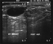 Surgeon Performed Ultrasound